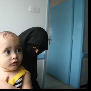 فرق صحیة متنقلة تصل إلى 600 ألف طفل من المتضررین من النزاع فی الیمن