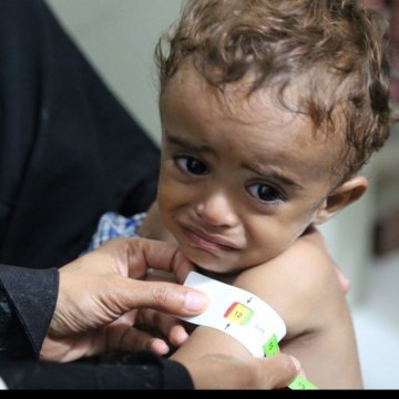 الیونیسف: 1.4 ملیون طفل قد یموتون خلال العام الحالی بسبب الجوع