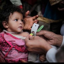 مؤتمر رفیع المستوى لإعلان التعهدات لدعم الیمن - Yemen_UNICEF_2017