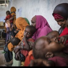  - الیونیسف: ارتفاع عدد الأطفال الصومالیین الذین یعانون من سوء التغذیة الحاد بمقدار 50%