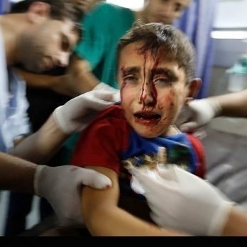 هشدار سازمان ملل نسبت به وقوع فاجعه بهداشتی در غزه