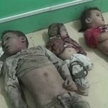 گزارش سازمان ملل از فاجعه کشتار کودکان یمنی توسط متجاوزان عربستانی