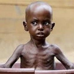 کودکان جمهوری آفریقای مرکزی از گرسنگی می میرند