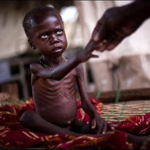 گسترش جهانی سوءتغذیه