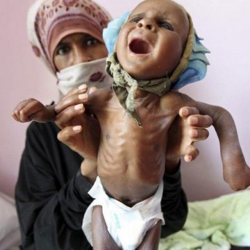 فاجعه قرن در یمن