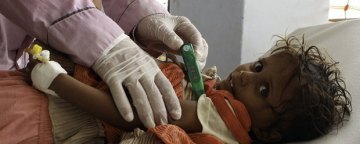 هشدار نهادهای حقوق بشری نسبت به شرایط اسفبار کودکان یمنی