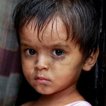 «وبا» مشکل تازه پناهجویان روهینگیایی
