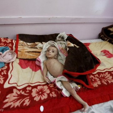سازمان جهانی مهاجرت: یمن در آستانه یک فاجعه انسانی است