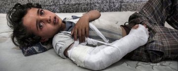 جنگ و اختلالات روحی و روانی وارده بر هشتاد هزار کودک یمنی