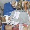  اشتباه-انسانی-یا-جنایت-جنگی - هشدار سازمان ملل به عربستان درباره جنایات هولناک علیه کودکان یمن