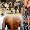  معترضان-فرانسوی-با-فلش-بال-پلیس-کور-می‌شوند - بی توجهی فرانسه به نقض حقوق بشر در عربستان