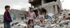  بحران-کودکان-یمنی-در-میانه-بحران-جنگ - تجاوز عربستان به یمن و نقض قوانین بین‌المللی