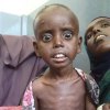  سازمان-ملل-از-افزایش-شمار-نیازمندان-به-کمک-غذایی-در-اتیوپی-خبر-داد - بحران غذایی 6 میلیون کودک را در اتیوپی تهدید می کند