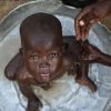  گسترش-جهانی-سوءتغذیه - میلیون‌ها نفر در کشورهای مختلف درخشونت و گرسنگی گرفتار شده‌اند