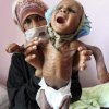 ائتلاف-سعودی-اماراتی-در-فهرست-سیاه-ناقضان-حقوق-کودکان - فاجعه قرن در یمن