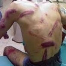  دفاع-از-قربانیان-خشونت - هشدار گزارشگر سازمان ملل درباره نقض حقوق بشر در بحرین