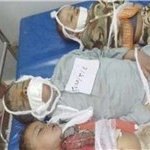  جنایت-جنگی - هشدار سازمان ملل به عربستان درباره جنایات هولناک علیه کودکان یمن