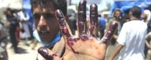 بررسی تجاوز عربستان به یمن از منظر حقوق بین‌الملل - yemen people