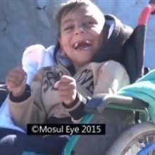 فتوای داعش برای کشتن کودکان با معلولیت ذهنی - کودک معلول