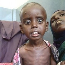  اتیوپی - بحران غذایی 6 میلیون کودک را در اتیوپی تهدید می کند