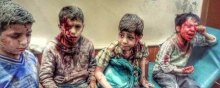 ائتلاف سعودی در لیست سیاه سازمان ملل؛ کودکان، قربانی تجاوزگری نظامی - کودکان یمنی