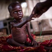  فقر - گسترش جهانی سوءتغذیه