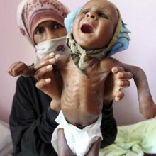  عربستان-سعودی - فاجعه انسانی/ یمن در معرض نسل کشی