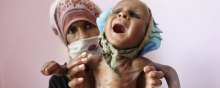  آمریکا - حمایت آشکار آمریکا از استراتژی قحطی و گرسنگی عربستان در یمن