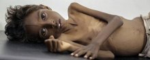  غذا - افزایش بحران جهانی ناامنی غذا و تاثیرات آن در یمن