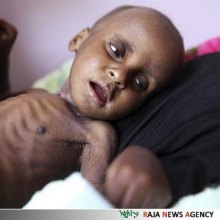  یمن - وبا/ بحران انسانی در یمن تا پایان سال 2017