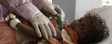  وبا - هشدار نهادهای حقوق بشری نسبت به شرایط اسفبار کودکان یمنی