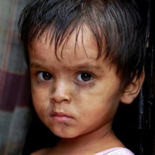  سازمان-تجارت-جهانی - «وبا» مشکل تازه پناهجویان روهینگیایی