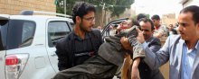  سازمان-ملل - واکنش‌های گسترده بین‌المللی به حمله جنگنده‌های سعودی به دانش‌آموزان یمنی
