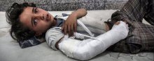  کودک - جنگ و اختلالات روحی و روانی وارده بر هشتاد هزار کودک یمنی