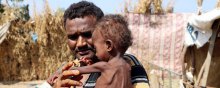  حقوق-بشر - نگاهی به برخی آمارها از وضعیت نابسامان حقوق بشر در یمن