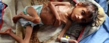  جنگ - فقر و گرسنگی در یمن، بحرانی بی‌پایان