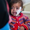  Millions-of-children-in-Yemen-vaccinated-against-polio-through-UN-backed-campaign - Children paying the heaviest price as conflict in Yemen enters third year – UN