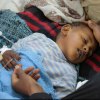  Yemen-s-children-have-suffered-enough--UNICEF-official-warns-of-cholera-rise-malnutrition - Cholera cases in Yemen may reach 130,000 in two weeks, UNICEF warns