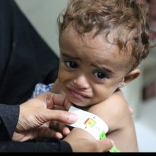  OCHA - Yemen: UN, partners seek $2.1 billion to stave off famine in 2017