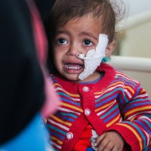  famine - Children paying the heaviest price as conflict in Yemen enters third year – UN